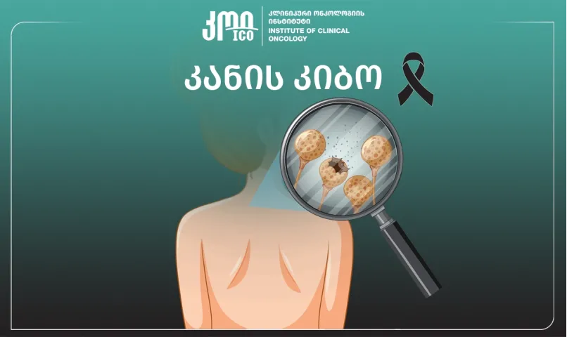 Рак кожи: факторы риска и современные стратегии лечения