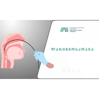 ლარინგოსკოპია