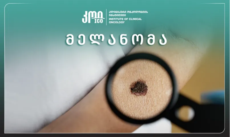 მელანომა
