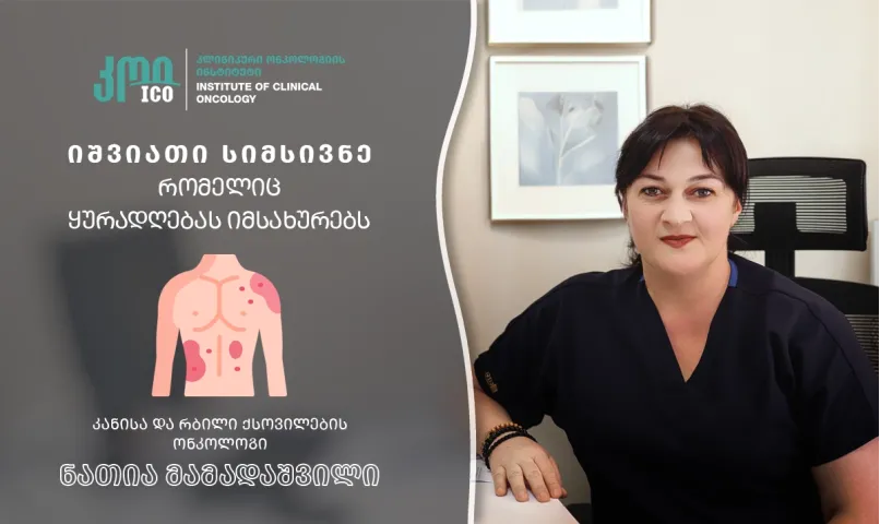 რბილი ქსოვილების სარკომა