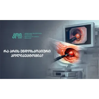 რა არის ენდოსკოპიური პოლიპექტომია?