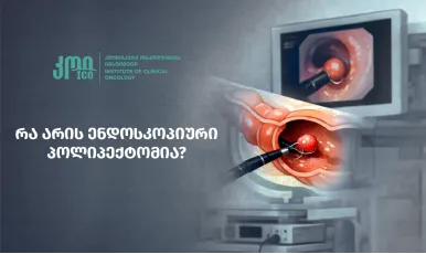 რა არის ენდოსკოპიური პოლიპექტომია?