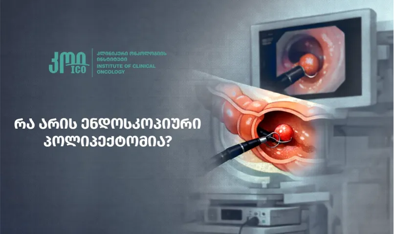 რა არის ენდოსკოპიური პოლიპექტომია?